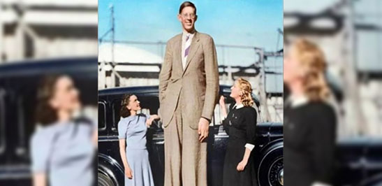 Robert Wdlow: The Gentle Giant – The Tallest Man in Recorded History